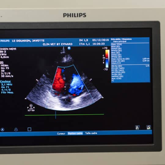 Echographie cardiaque